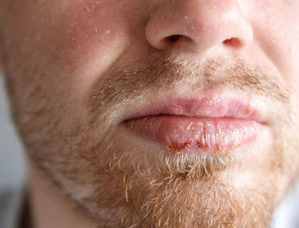 Beyond Simplex Symptoms